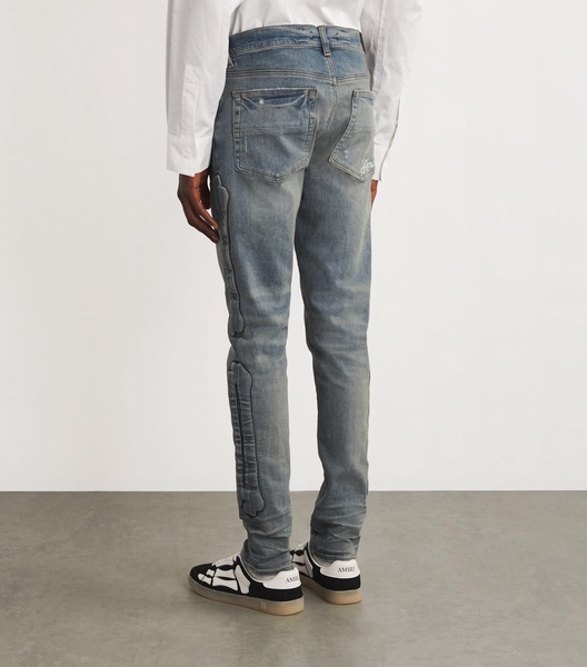 Bones Skinny Jeans