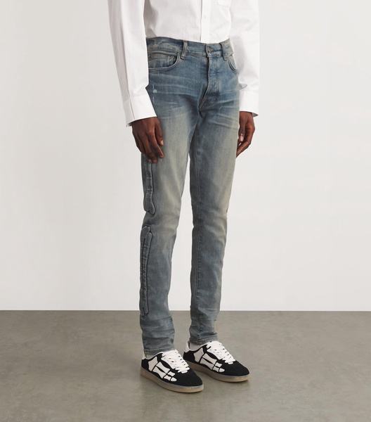 Bones Skinny Jeans
