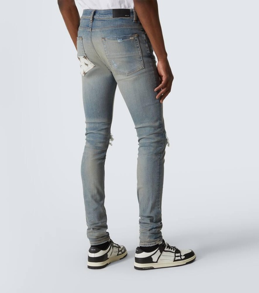 Micro Starburst distressed skinny jeans